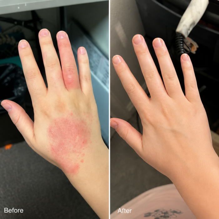Dermatitis & Gesunde Haut Creme – Lindert Juckreiz, Rötung und Schuppenbildung 50ml – Bild 9